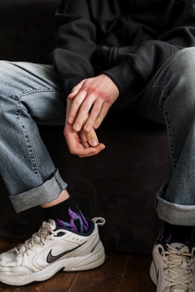How Damages Are Calculated In A Personal Injury Case?